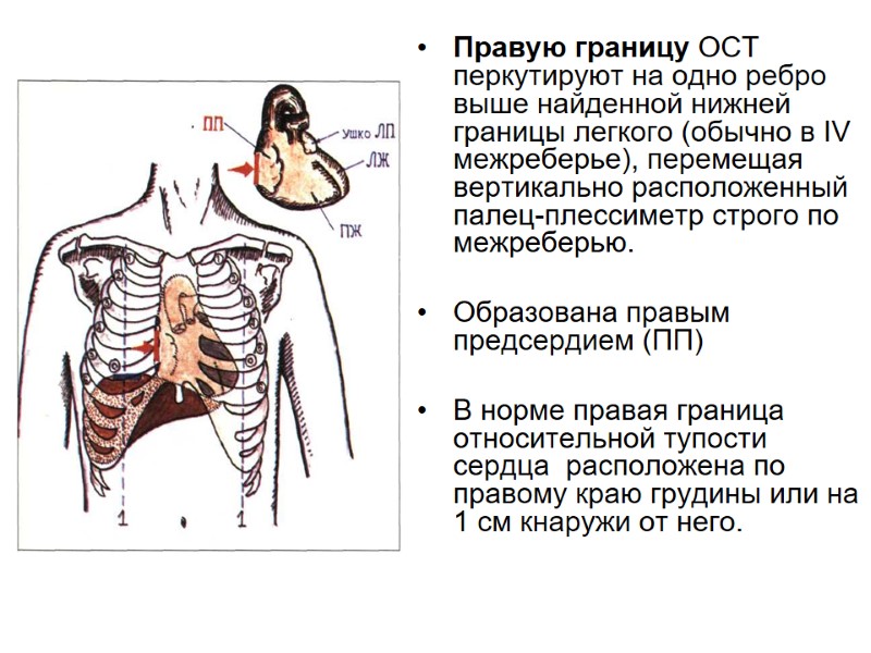 Правую границу ОСТ перкутируют на одно ребро выше найденной нижней границы легкого (обычно в